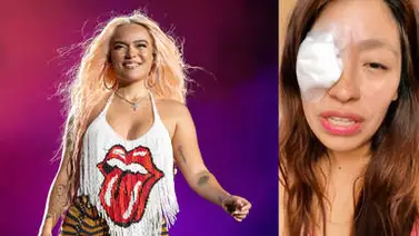 Fanática de Karol G resultó herida durante concierto (+Detalles) Fanática de Karol G resultó herida durante concierto (+Detalles)