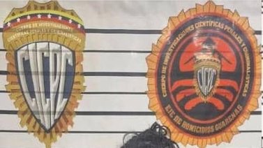 Detenida por quemar a su pequeño hijo con utensilios de cocina