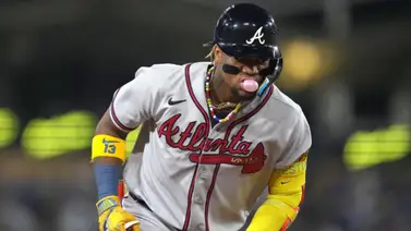 MLB: Ronald Acuña Jr. sorprende a todos gracias a su velocidad (+Video) MLB: Ronald Acuña Jr. sorprende a todos gracias a su velocidad (+Video)