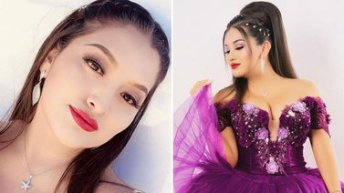 Muere la cantante ‘Muñequita Milly’ tras someterse a una liposucción