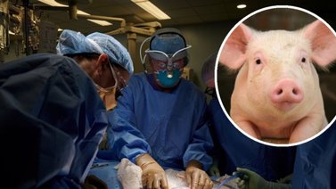 Boston | ¿Qué pasó con el primer paciente trasplantado con riñón de cerdo?