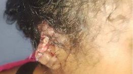 Le arrancó un pedazo de oreja a su pareja en una discusión (+Detalles)