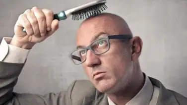 Una vacuna podría acabar con la alopecia Una vacuna podría acabar con la alopecia