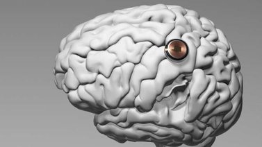 Primer humano con implante cerebral de Neuralink controla videojuegos