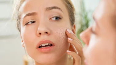 ¿Tienes piel seca? Así debes exfoliarla para evitar daños
