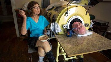 La historia de Paul Alexander, quien falleció luego de vivir 70 años en un pulmón de acero