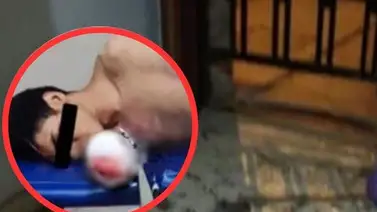 Delincuente venezolano pierde una mano al explotar una dinamita (+Detalles) Delincuente venezolano pierde una mano al explotar una dinamita (+Detalles)