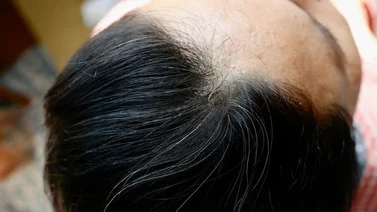 Conozca las mejores marcas de tinte para tapar las canas