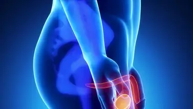 ¡OJO PELAO HOMBRES! ¿Qué pasa cuando se eyacula con sangre? ¡OJO PELAO HOMBRES! ¿Qué pasa cuando se eyacula con sangre?