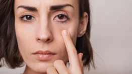 Ojos rojos: te decimos qué lo causa y cómo sanarlos