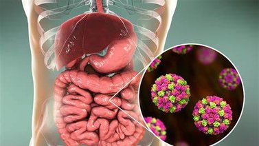 Advierten que el norovirus se propaga en EEUU: síntomas y prevención