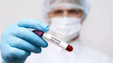 Registran primera muerte por virus Alaskapox