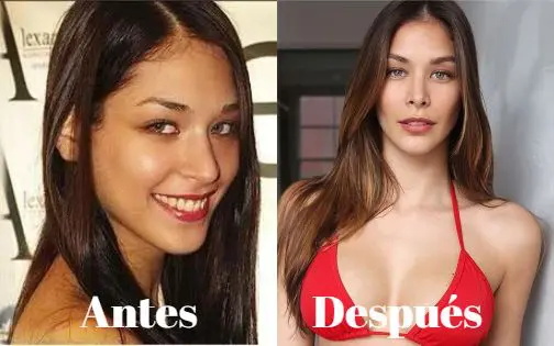 Este es el antes y después de la exreina de belleza Dayana Mendoza (+Fotos) Este es el antes y después de la exreina de belleza Dayana Mendoza (+Fotos)