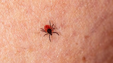 Alertan sobre enfermedad transmitida por una garrapata: Sepa más