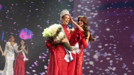 Así era Miss Venezuela, Ileana Márquez, antes de echarse cuchillo (+foto de la transformación)