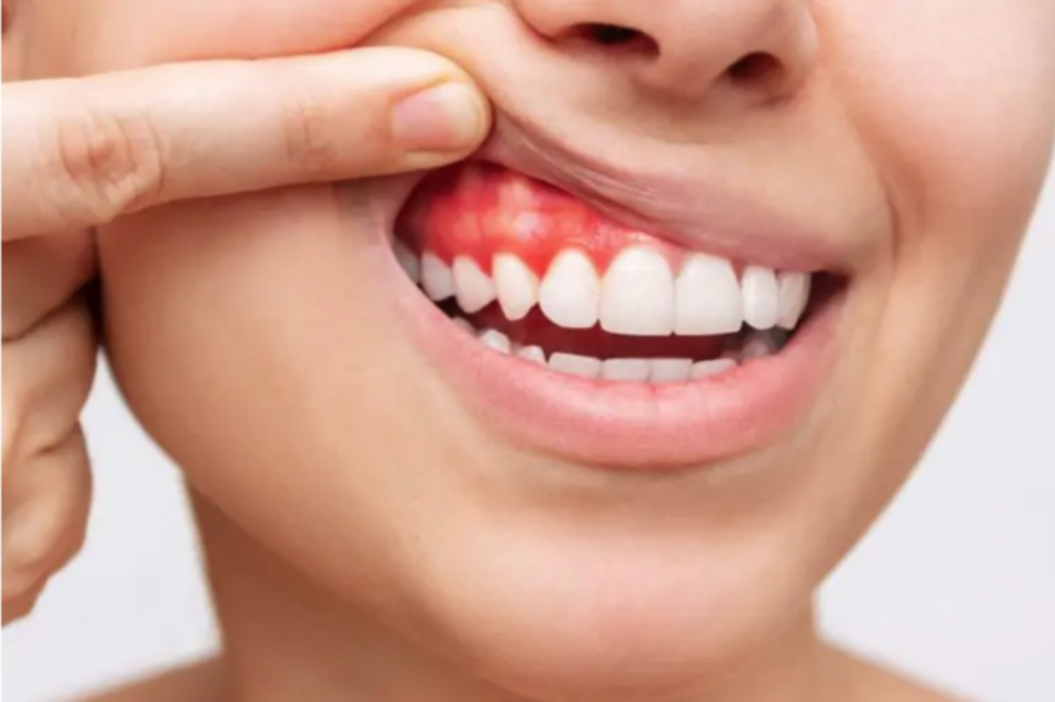 Así podrás eliminar esta dolencia dental Así podrás eliminar esta dolencia dental
