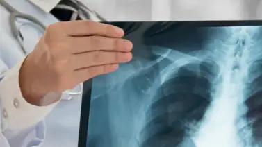 ¿Por qué hay que someterse a una radiografía? ¿Por qué hay que someterse a una radiografía?