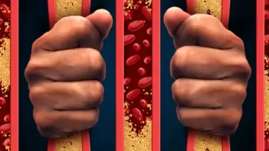 Llegó la vacuna contra el colesterol y estos son los elegibles para aplicársela Llegó la vacuna contra el colesterol y estos son los elegibles para aplicársela