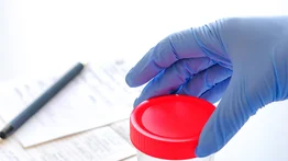 Esperma: mejora su calidad para evitar infertilidad