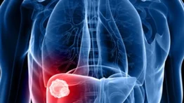 ¡Alerta! Brote de hepatitis E deja al menos doce muertos