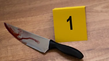 ¡Brutal agresión! Hombre desfiguró el rostro a su concubina con un cuchillo