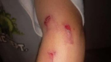 Sujeto violaba a su hijastra y quemaba con cigarrillos al hermanito