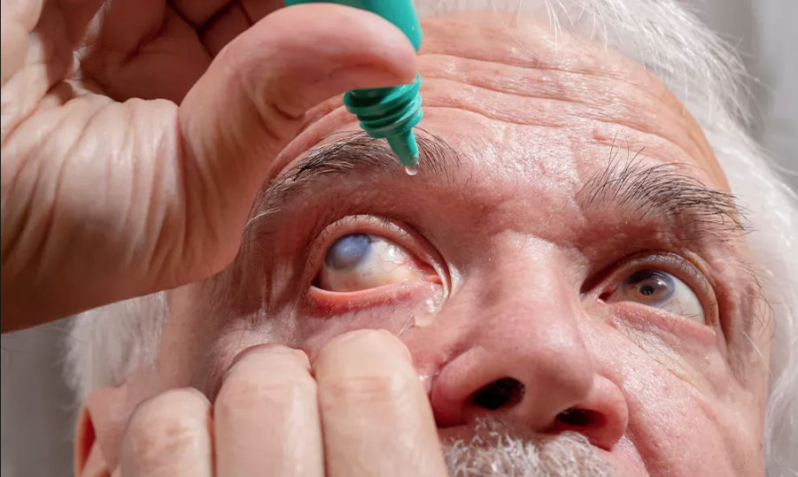 Tratamiento y control del glaucoma Tratamiento y control del glaucoma