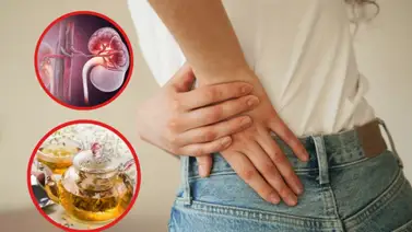 Cómo expulsar las piedras de los riñones Cómo expulsar las piedras de los riñones