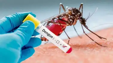 Estos son los síntomas que produce el dengue Estos son los síntomas que produce el dengue