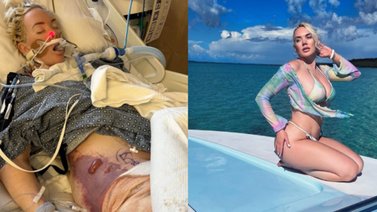 Reconocida modelo sufre amputación de una pierna (+Detalles)