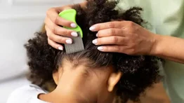 ¡Increíble! Madre se niega a sacarle los piojos a su hija porque son “seres sintientes”