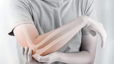 ¿Qué tipo de cáncer es el sarcoma? ¿Qué tipo de cáncer es el sarcoma?