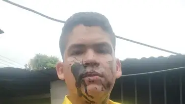 Diez personas que asistieron a mitin de Henrique Capriles Radonski resultaron heridas Diez personas que asistieron a mitin de Henrique Capriles Radonski resultaron heridas