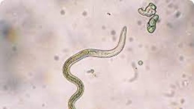 ¡Cuidado! Mira lo que tienes qué saber sobre la larva migratoria