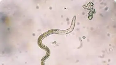 ¡Cuidado! Mira lo que tienes qué saber sobre la larva migratoria ¡Cuidado! Mira lo que tienes qué saber sobre la larva migratoria