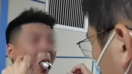 ¡Alerta! Terminó con un bombillo atorado en su boca por reto viral