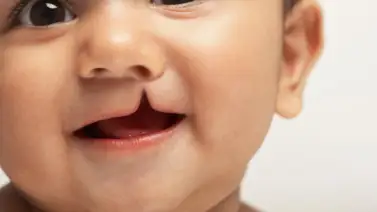 Conoce de qué trata el programa de Atención Materno Infantil Conoce de qué trata el programa de Atención Materno Infantil