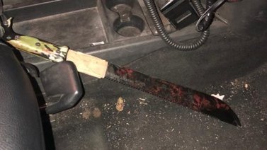 ¡De terror! Agredió a su pareja con un machete (+Foto)