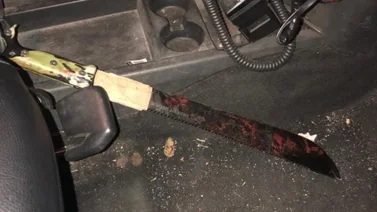 ¡De terror! Agredió a su pareja con un machete (+Foto)