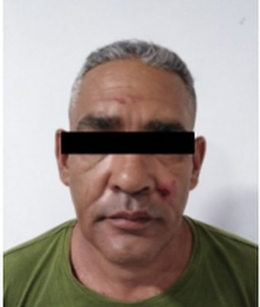 ¡De terror! Agredió a su pareja con un machete (+Foto) ¡De terror! Agredió a su pareja con un machete (+Foto)