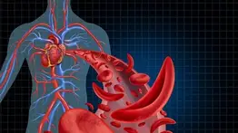 Un mal poco conocido ¿Sabe usted qué es la drepanocitis?