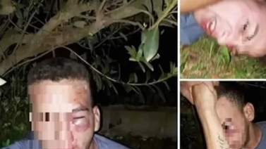 Lincharon a un joven por acoso sexual contra una menor de edad: Le desfiguraron el rostro