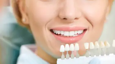 Estética dental recomendada para blanquear los dientes Estética dental recomendada para blanquear los dientes