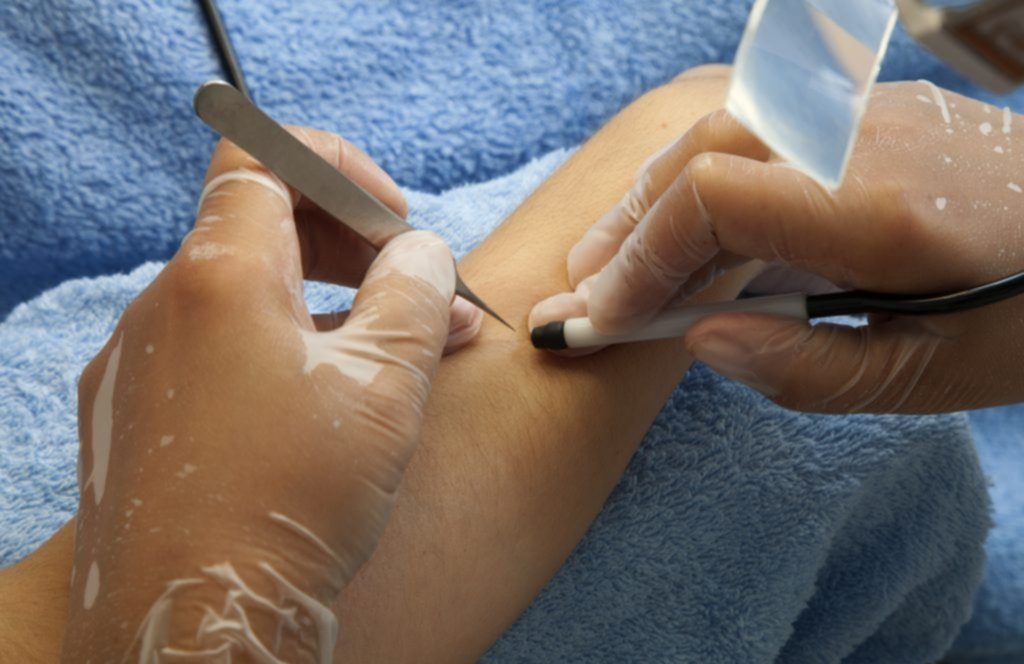 Depílate con resultados permanentes sin sentir dolor Depílate con resultados permanentes sin sentir dolor