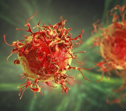 Causas principales del cáncer en la piel Causas principales del cáncer en la piel