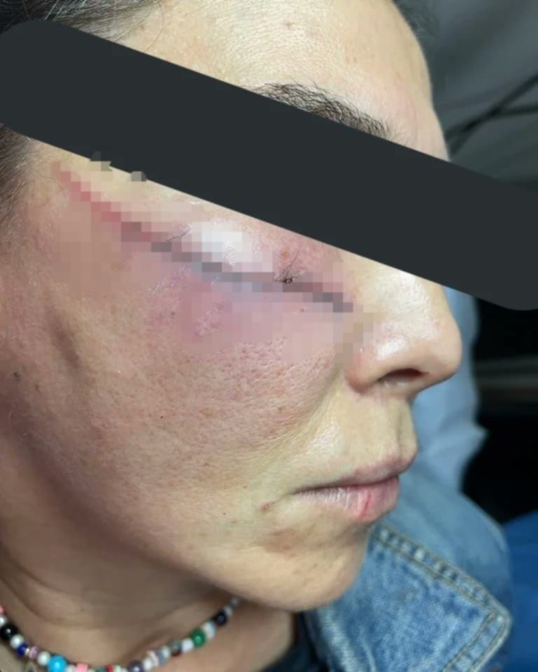 ¡Detenido! Delincuente agredió salvajemente a mujer en un estacionamiento ¡Detenido! Delincuente agredió salvajemente a mujer en un estacionamiento