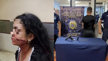 Funcionario policial disparó en el rostro a una compañera (+Detalles)