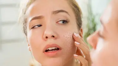 ¿Tienes la piel reseca? ¡Ponle un freno! ¿Tienes la piel reseca? ¡Ponle un freno!