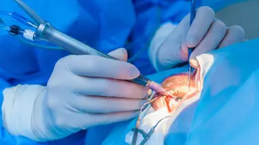 Activan plan de cirugía oftalmológica en este hospital de Caracas Activan plan de cirugía oftalmológica en este hospital de Caracas