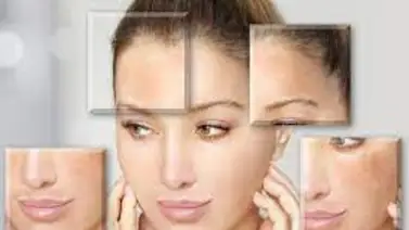 Remedios para minimizar las manchas en la piel Remedios para minimizar las manchas en la piel